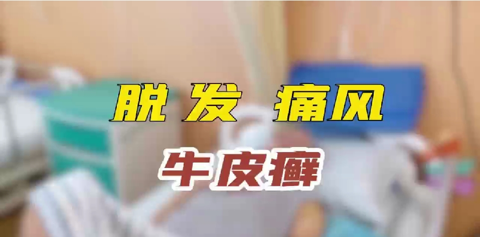 脱发 痛风  牛皮藓