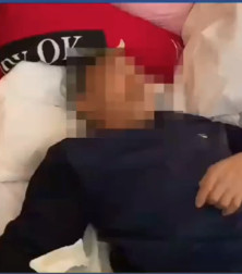 脑梗1个月的原ICU患者